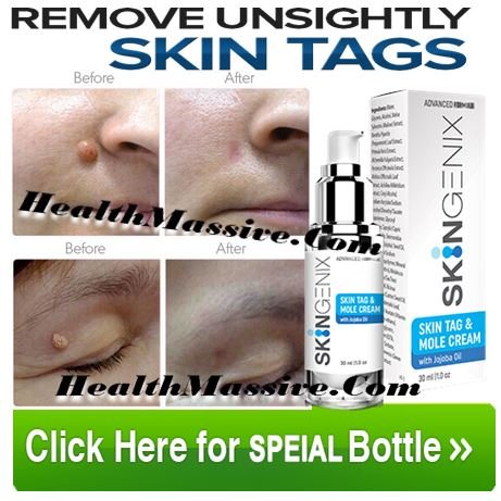 Skingenix-Buy-Now