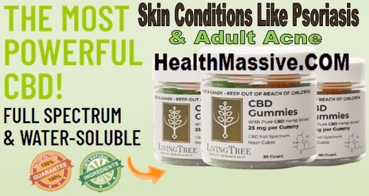 Living Tree CBD Gummies