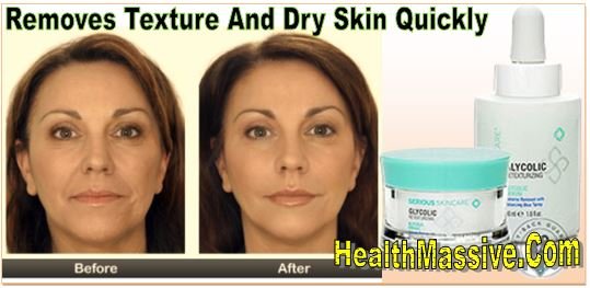 Glycolic Cream Cost