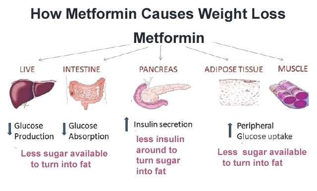 Metformin Cause For Weight loss